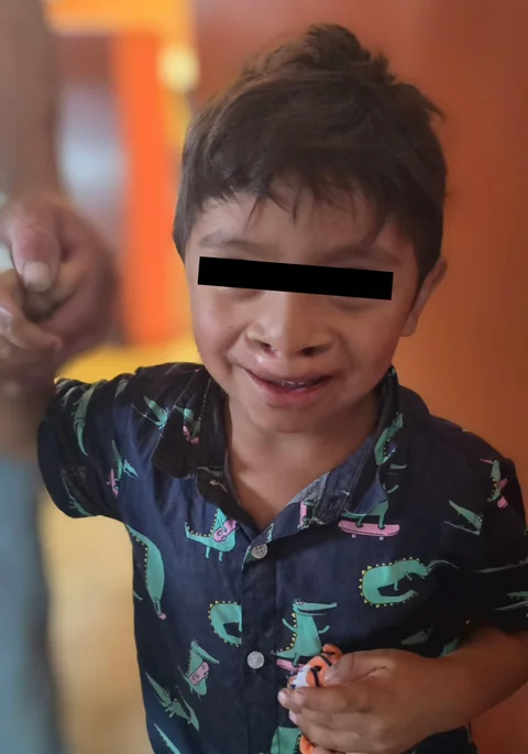 Lächelndes Kind nach Operation