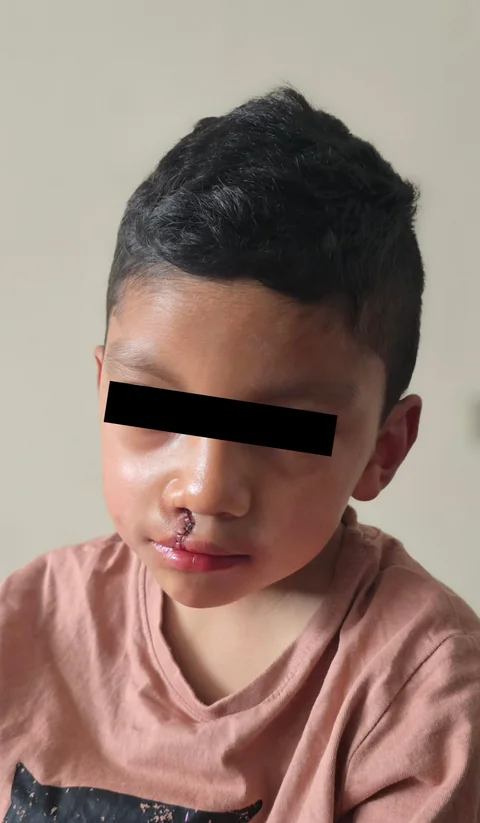Junge nach Operation